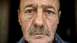 Cilt sağlığı ve yaşlanmaya bağlı hastalıklar arasında nasıl bir ilişki var?